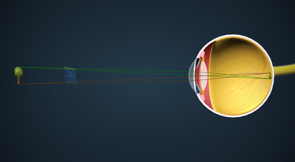 Харааны механизм