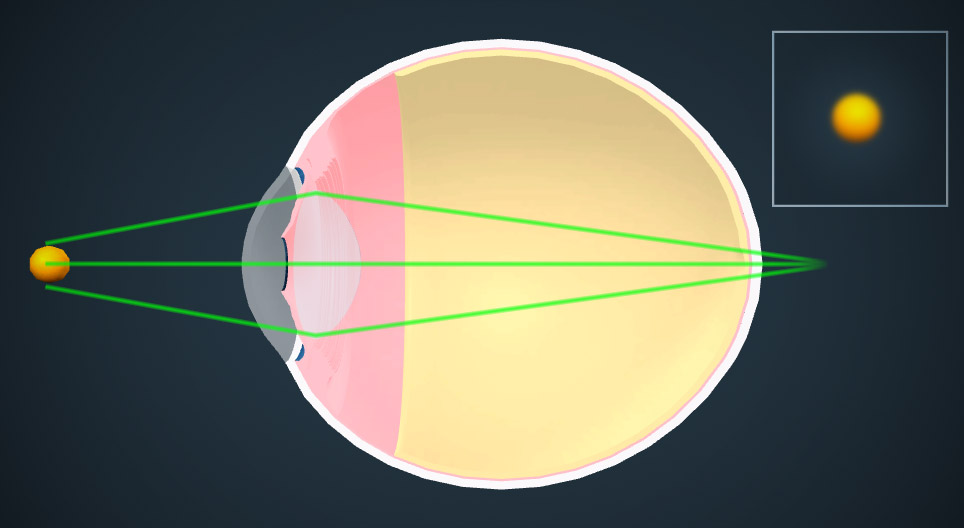 Хараа засах