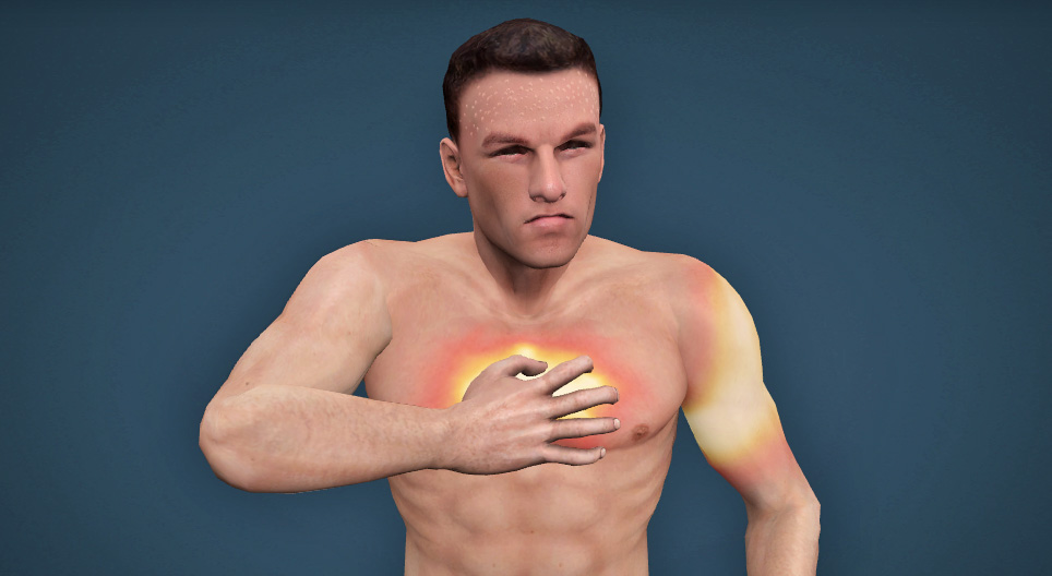 Зүрхний шигдээс