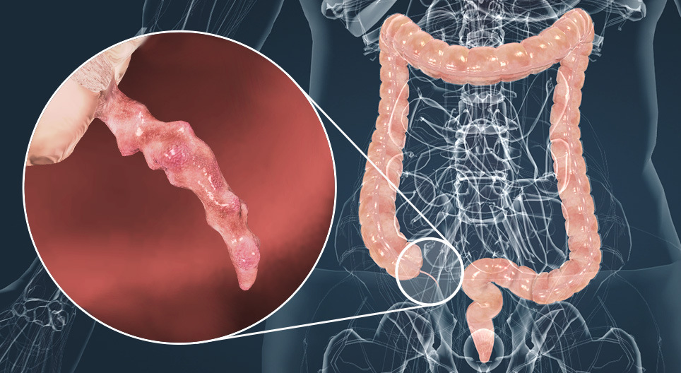 Мухар олгой