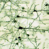 Мэдрэлийн эд