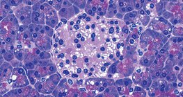 Нойр булчирхайн инсулин үүсгэдэг бүлэг эсүүд