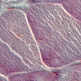 Шөрмөс (хөндлөн огтлол)