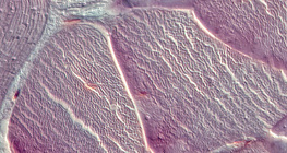 Шөрмөс (хөндлөн огтлол)