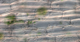 Ургамлын эпидермисийн эсүүд