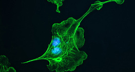 Цитоскелетон