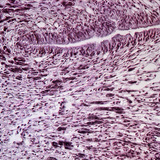 Эмгэн хумсны хөлний хөндлөн огтлол