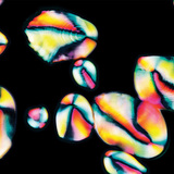 Төмсөн дэх цардуулын мөхлөгүүд