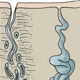 Арьсны булчирхайнууд: тосны булчирхай