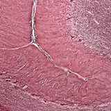 Хүний бага тархины огтлол