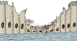 Тамхи татдаг хүний амьсгалын замын цоргон хучуур эд