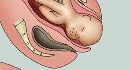 Хүүхэд төрөлт