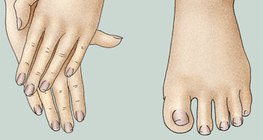 Зөв арчилсан гар, хөл