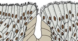 Олон эсийн булчирхай