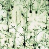 Тархины бор гадаргын мэдрэлийн эсүүд