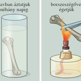 Csontok vizsgálata