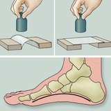 Хөлийн тавхайн нумны үзлэг