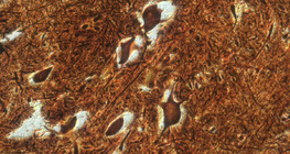 Нурууны мэдрэлийн эсүүд (үхэр)