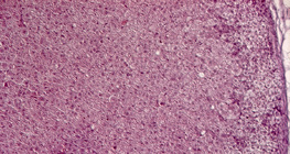 Бөөрний дээд булчирхайн хөндлөн огтлол