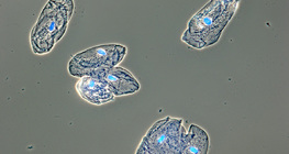 Хүний амны хөндийн салст бүрхүүлийн эсүүд