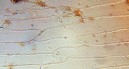 Сонгины навчны шүүслэг хальсны эсүүд