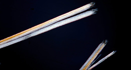 Салаалсан үсний үзүүр