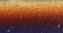 Гэрэлтдэг E.coli бактери үсэн дээр