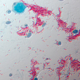 Сүрьеэ өвчин үүсгэгч (Mycobacterium tuberculosis)
