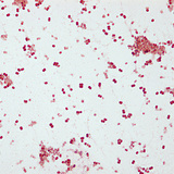 Заг хүйтэн өвчин үүсгэгч (Neisseria gonorrhoeae)
