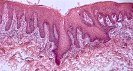 Хүний хэлний хөндлөн огтлол