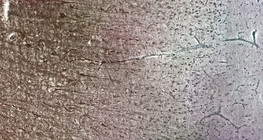 Хүний тархины бор гадар: төрөл бүрийн эсийн давхаргууд харагдаж байна