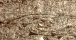 Хүний тархины бор гадар: том пирамид эсүүдийн давхарга харагдаж байна