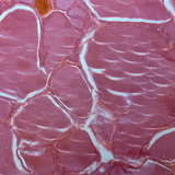 Бамбай булчирхайн хөндлөн огтлол