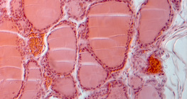 Бамбай булчирхайн хөндлөн огтлол