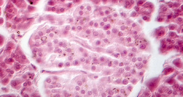 Нойр булчирхай (фазын тодосгогчтой зураг) - Лангерханс аралханы эсүүд бүдэгхэн харагдаж байна