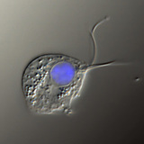 Трихомониазийн халдварт бодис (дифференциал интерференцийн контрастын зураг, эсийн цөм нь цэнхэр өнгөөр будагдсан)