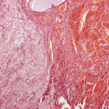 Гипофиз булчирхай (уртааш огтлол, бага зэрэг томруулсан)