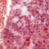 Гипофиз булчирхайн огтлол