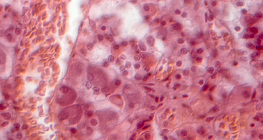 Гипофиз булчирхайн огтлол