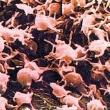 Platelets