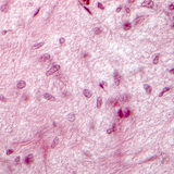 Гипофиз булчирхайн огтлол