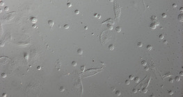 Дрозофила авгалдайн цусны улаан эсүүд