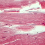 Шөрмөс (уртааш огтлол)