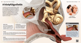Middle Ear Infection, Otitis Media
