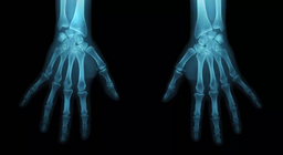 Шүүх эмнэлгийн антропологич болцгооё.