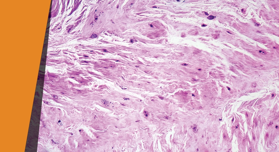 Чиглэсэн цохилт